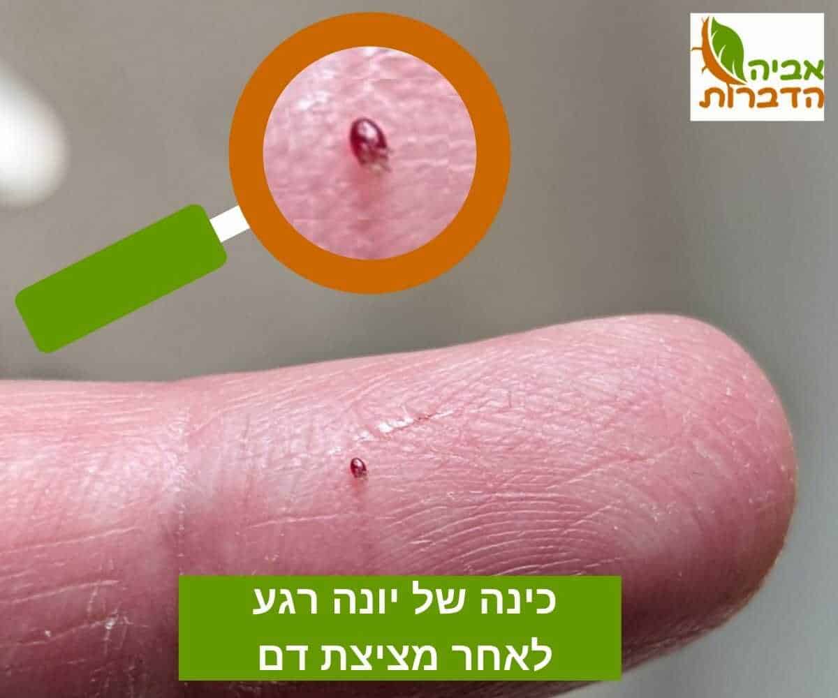 כינה של יונה רגע לאחר מציצת דם